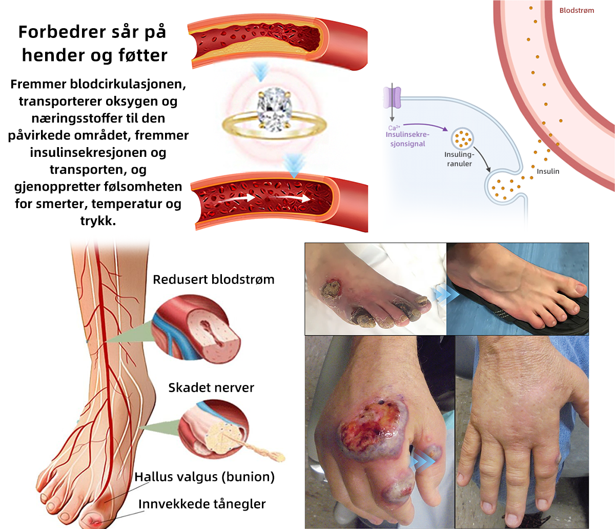 𝘾𝙕𝙏𝙄𝘾𝙇𝙀™Magnetisk terapi moissanittdiamantring (💍Ringen er justerbar og er en uniseksmodell)🛒🛒