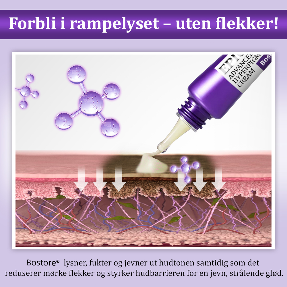 Godkjent av HELFO ✅💝| Bostore® EPIGLOW MelanEX Avansert Anti-Hyperpigmenteringskrem 💝