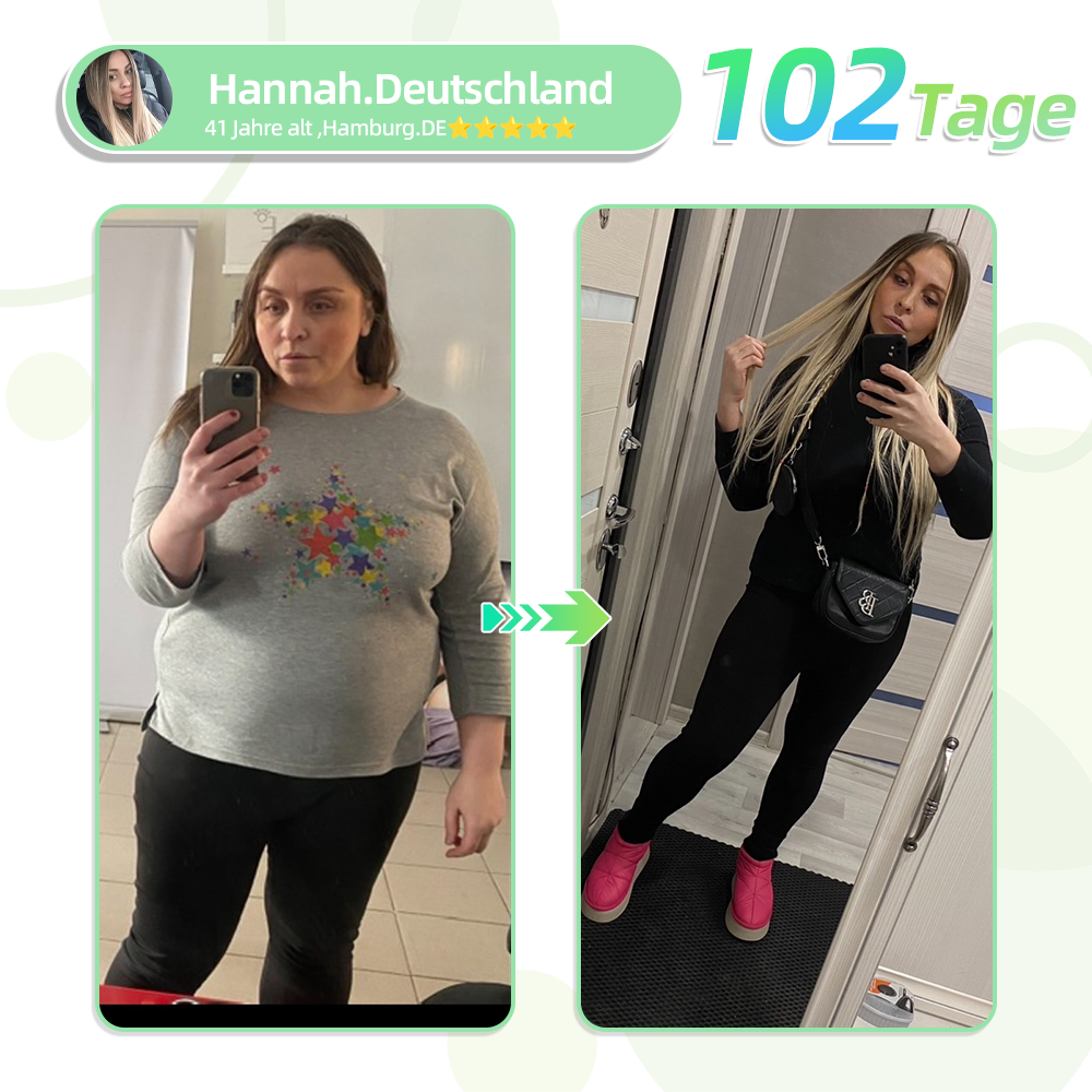 【7 dager for å se resultater】👨⚕️Oyikey®SMGT-GLP-1 Nano mikronålplaster (Painless, langvarig, mot diabetes, fedme og hjerte- og karsykdommer) 🍒