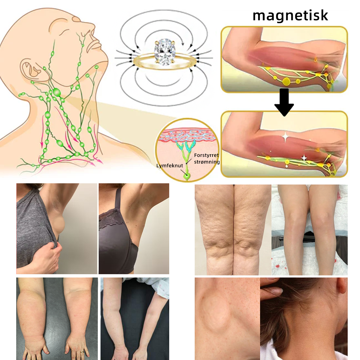 𝘾𝙕𝙏𝙄𝘾𝙇𝙀™Magnetisk terapi moissanittdiamantring (💍Ringen er justerbar og er en uniseksmodell)🛒🛒